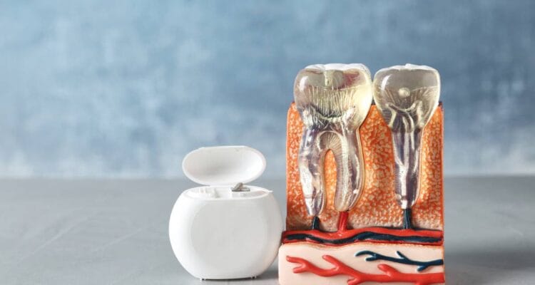 Tratament de canal Art White Dental Clinic Ploiesti