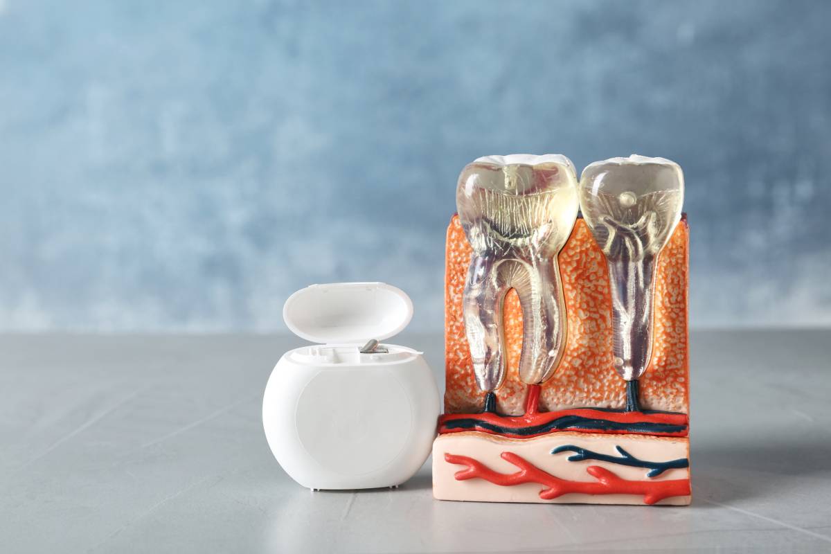 Tratament de canal Art White Dental Clinic Ploiesti